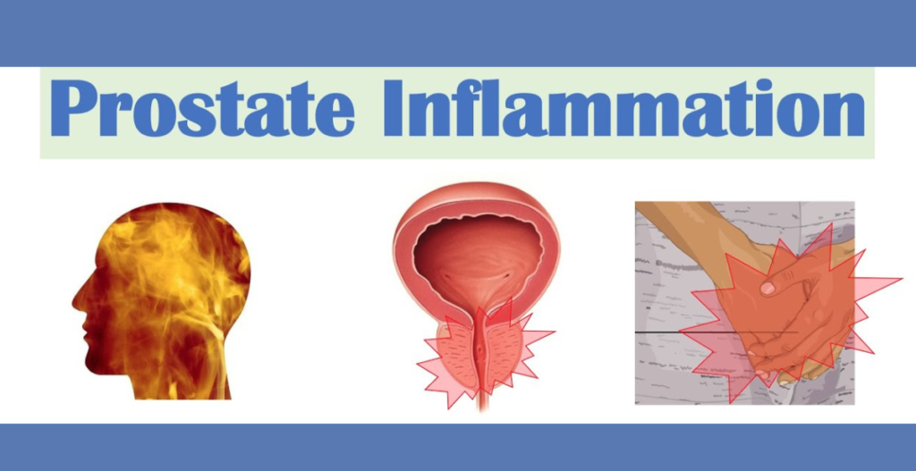 Prostate Inflammation